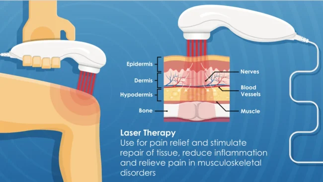 การรักษาด้วย Low-Level-Laser-Therapy