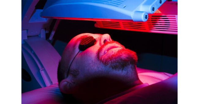 การรักษาสิวด้วย Photodynamic therapy (PDT)