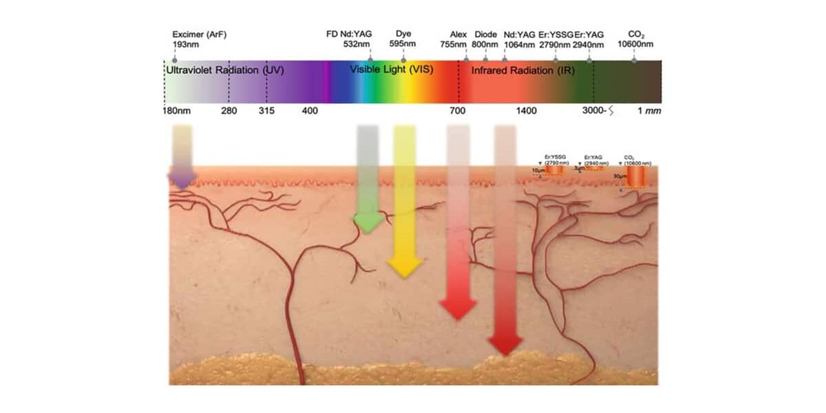 รักษาด้วย Excimer Laser Phototherapy