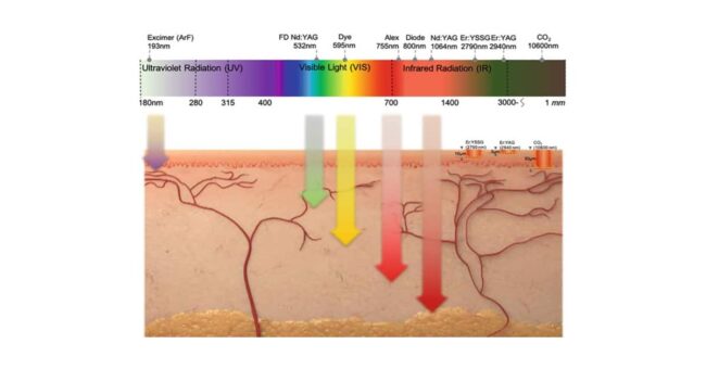 รักษาด้วย Excimer Laser Phototherapy