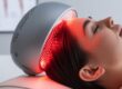 Low Level Laser Therapy (LLLT) for Hair Growth- เทคโนโลยีกระตุ้นผมงอกใหม่ที่ปลอดภัยและมีงานวิจัยรองรับ